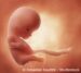 Ungeborenes Kind - 10 Wochen alt